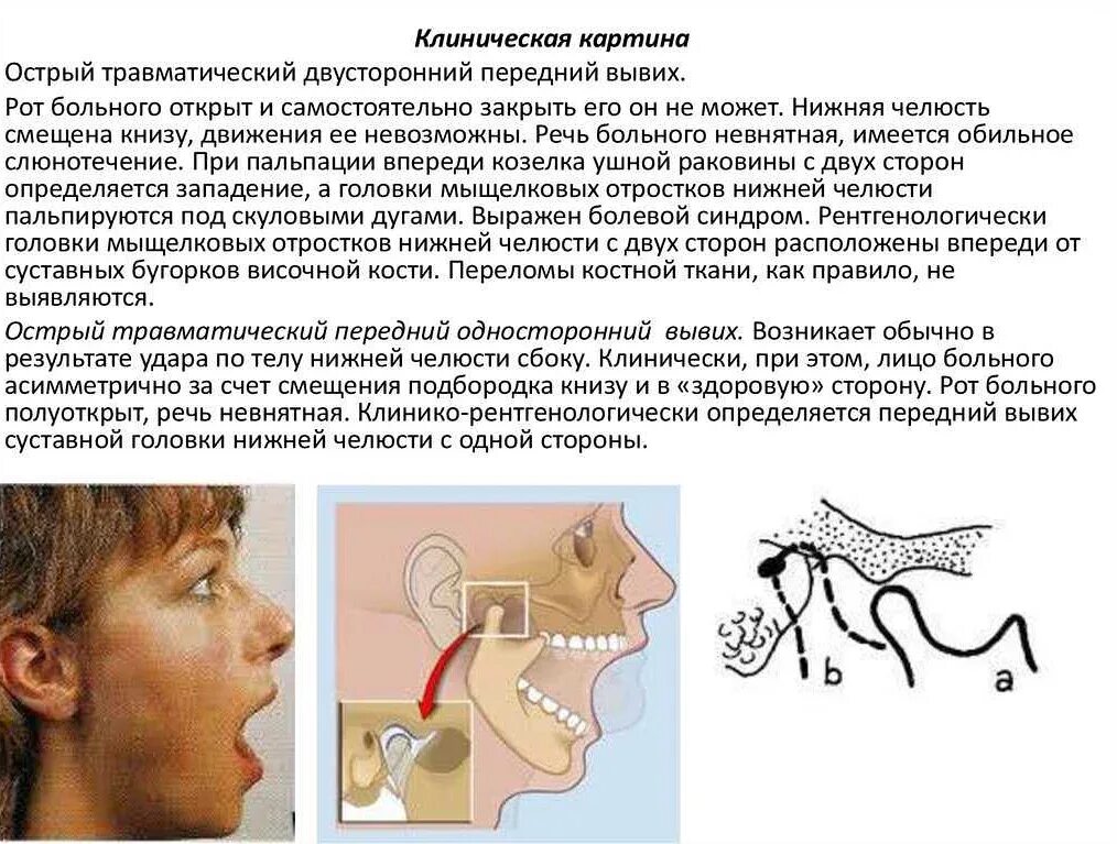 Можно ли рот