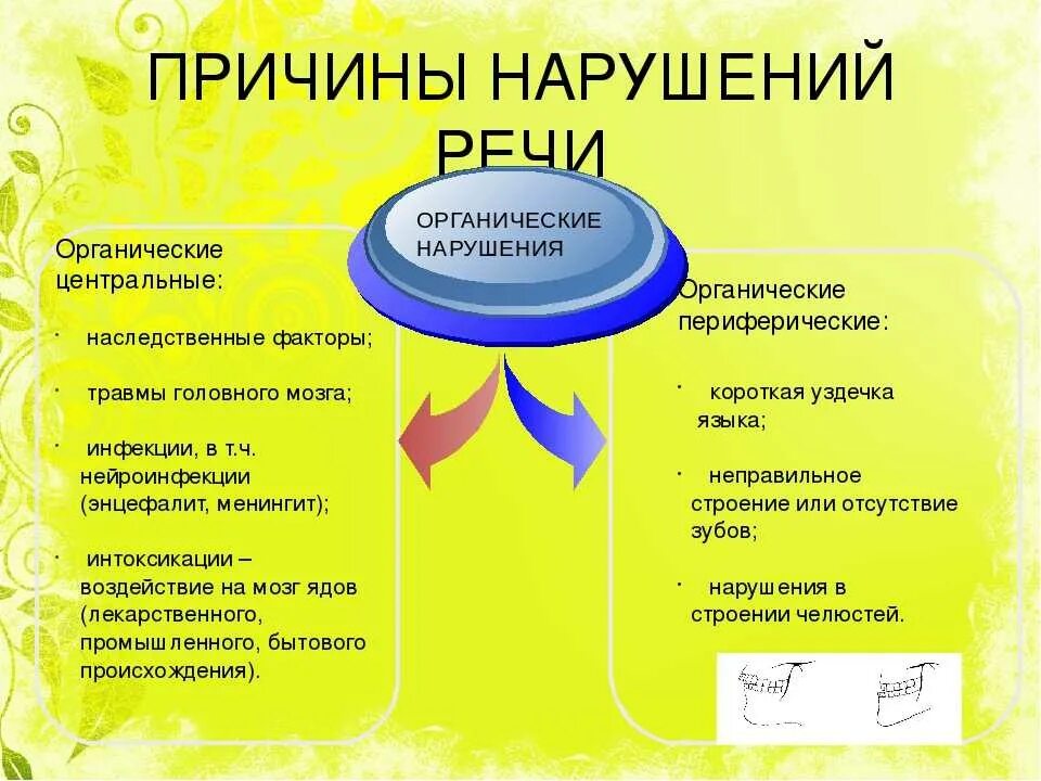 Основные нарушения речи у детей. Органические и функциональные причины речевых нарушений. Функциональные причины нарушения речи у детей. Функциональные причины речевых нарушений в дошкольном возрасте. Этиология речевых нарушений схема.