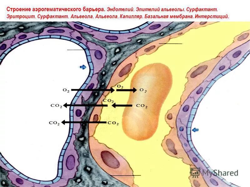 альвеолярный эпителий. альвеолоциты 1 2 типа строение гистология. альвеолярный макрофаг строение. аэрогематический барьер сурфактант. строение альвеолоцита 2 порядка.