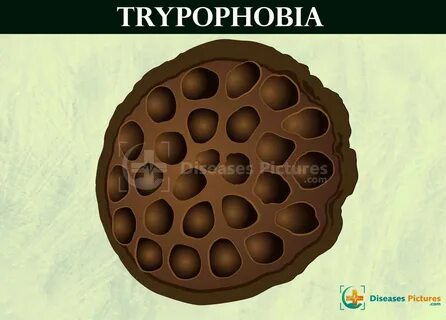 Cause holes
