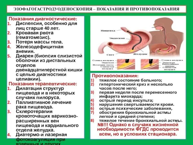 ФГДС показания и противопоказания. Методика выполнения ЭГДС. ФГДС противопоказания для проведения. Биопсия язвы