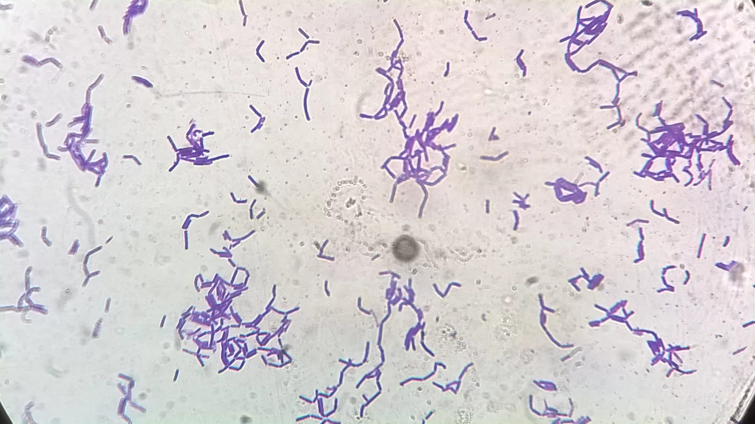 Haemophilus в мазке у мужчин. Палочки Дедерлейна микроскопия. Лактобациллы палочки Дедерлейна. Лактобактерии палочки Дедерлейна. Lactobacillus Acidophilus микроскопия.