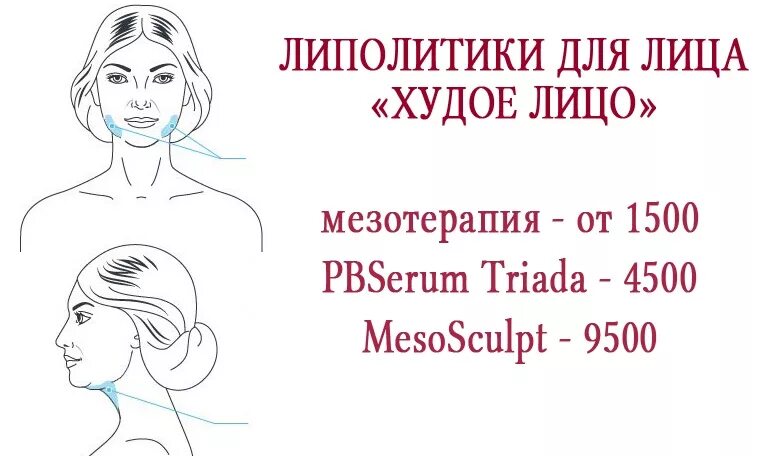 Схема введения липолитиков в живот. Нужны модели на липолитики. Липолитики схема действия. Приглашаем моделей на липолитики. Схема уколов липолитиков.