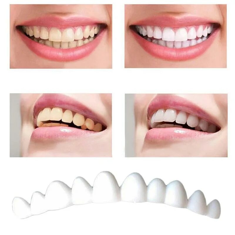Идеальные зубы. Накладные зубы perfect smile veneers. Виниры комплект snap-on smile. Виниры perfect smile veneers. Композитные виниры оттенки.