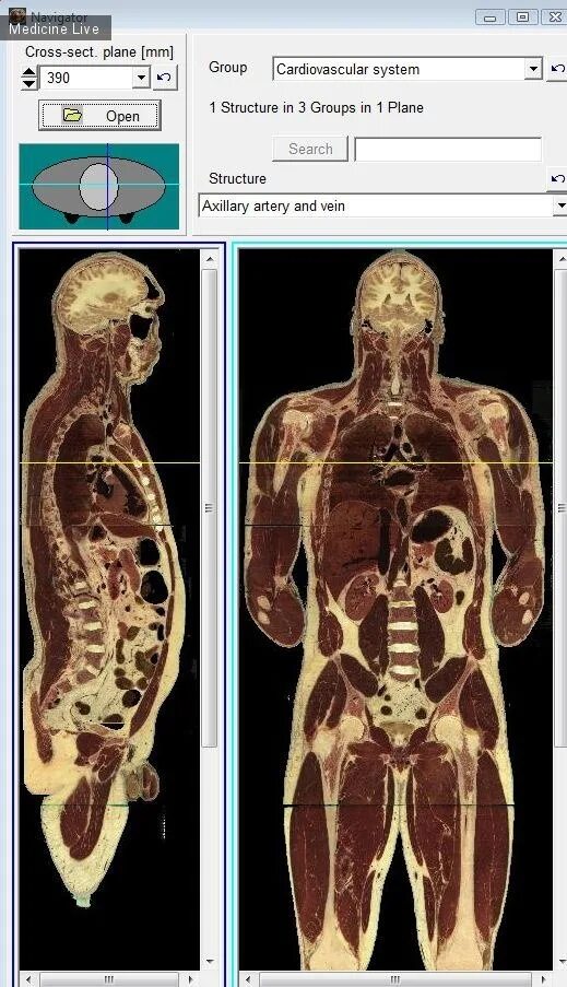 Поперечный срез тела человека. Сагиттальный срез головы анатомия. Сагиттальный разрез головы человека. Сагиттальный распил черепа анатомия. Срез человеческого тела.