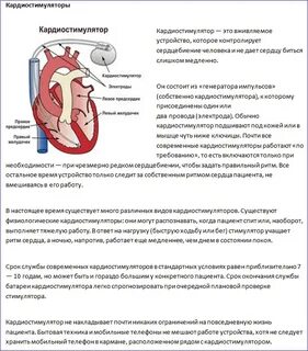 Восстановление после кардиостимулятора