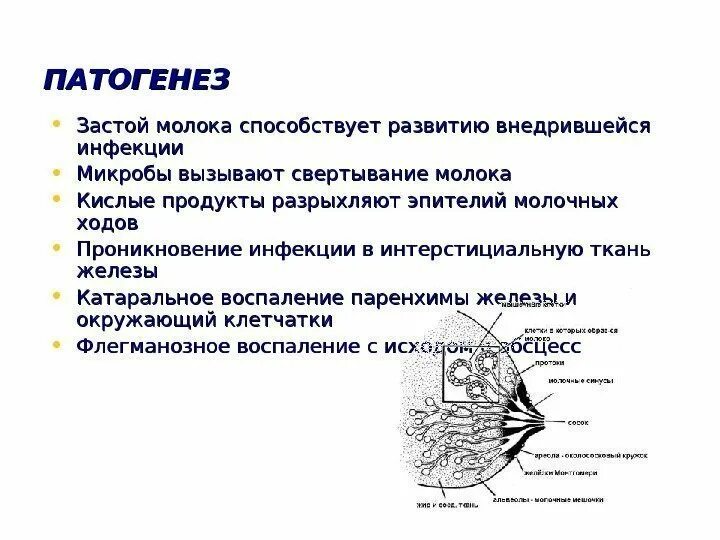 Лактостаз патогенез. Застой грудного молока. Лактостаз этиология. Лактостаз застой молока. Лактостазы у кормящей мамы