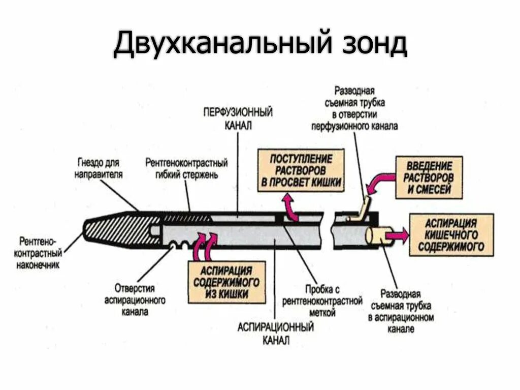 Зонд принцип. Двухканальный зонд Сейлема. Зонд желудочно-кишечный двухканальный силиконовый. Назоинтестинальный зонд для питания. Двухканальный зонд для питания.