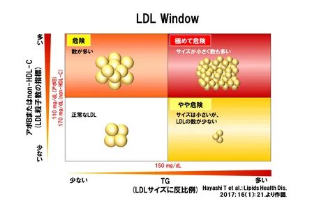 small dense LDL(超 悪 玉 コ レ ス テ ロ-ル)測 定 に つ い て 有 楽 橋 ク リ ニ ッ ク.