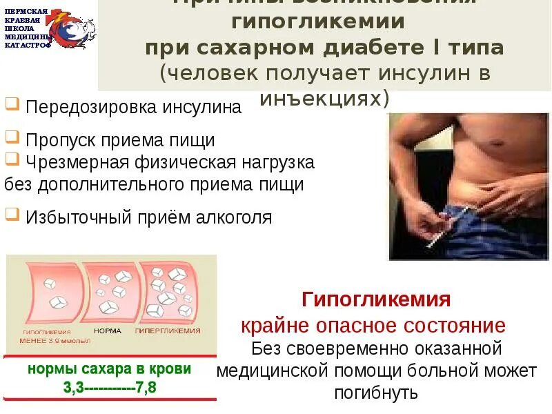 Симптомы гипогликемии при сахарном диабете 2 типа. Гипогликемия при сахарном диабете 1 типа. гипогликемия при сахарном диабете 2 типа. причины гипогликемии при сахарном диабете. симптомы гипогликемии при диабете 1 типа.