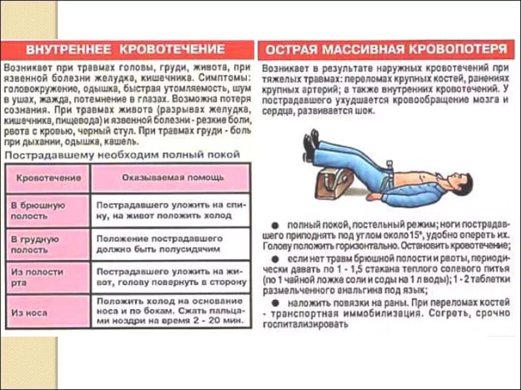 Пострадавшему с сильным наружным кровотечением. Транспортировка пострадавшего с травмой живота производится. Транспортировка при внутреннем кровотечении. Причины внутреннего кровотечения. Транспортировка больных с кровотечением.