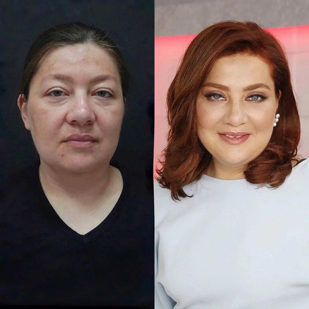 Жизнь женщины до и после 1 косметический продукт, который моментально преображает возрастную женщину Прос