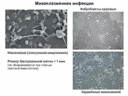 Что такое микоплазменная инфекция