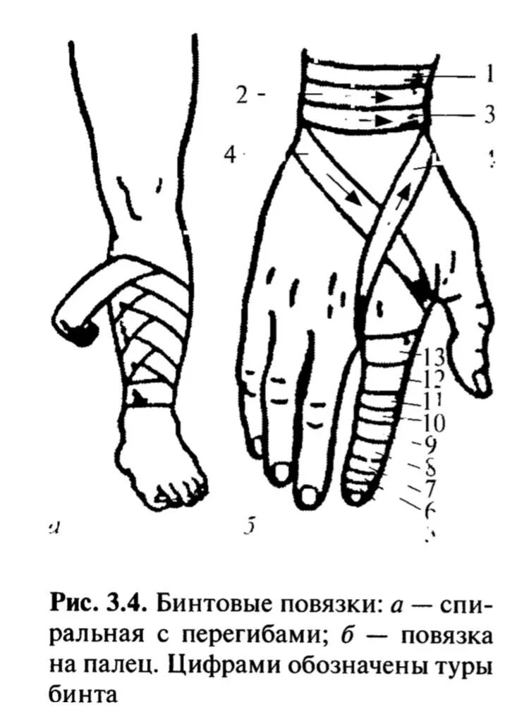 Повязка на руку схема. Десмургия наложение повязки на палец. Техника наложения бинтовых повязок. Техника бинтования десмургия. Десмургия бинтовая повязка на палец.