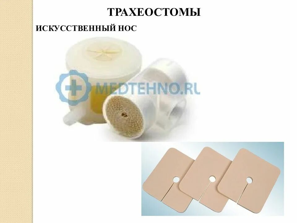 Искусственная стома