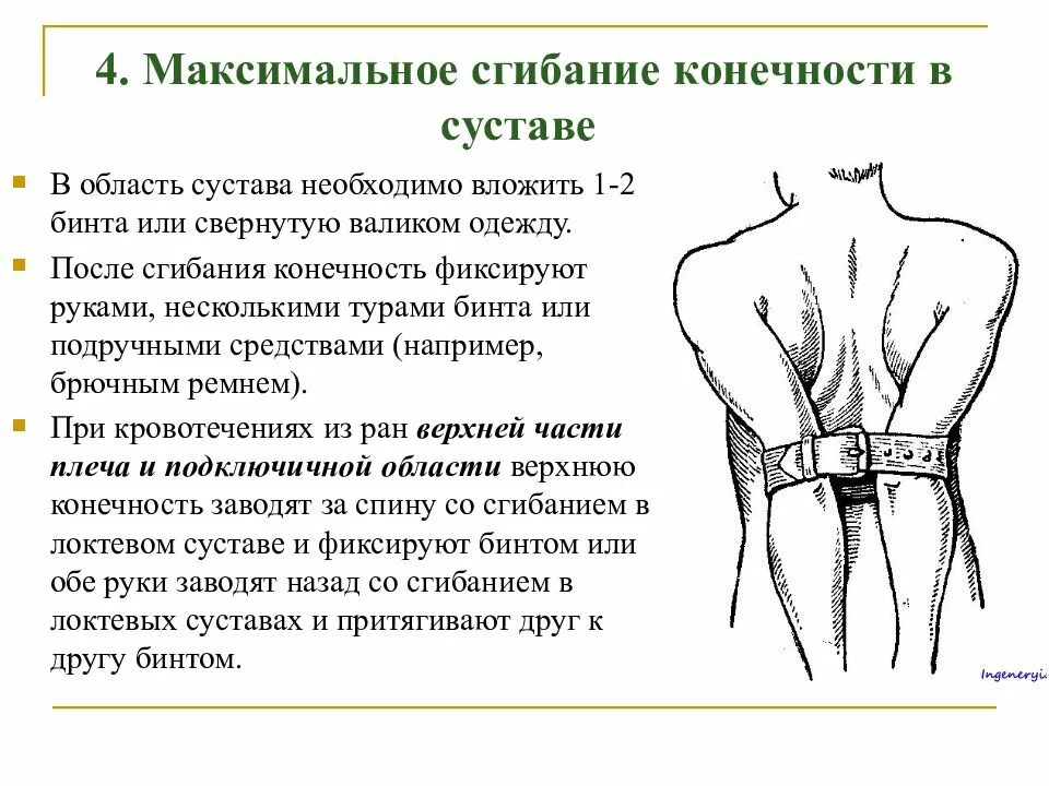 Остановка кровотечения путем сгибания конечности. Максимальное сгибание конечности в суставе. Остановка кровотечения методом максимального сгибания. Остановка кровотечения максимальным сгибанием конечности алгоритм. 4. Максимальное сгибание конечности в суставе..