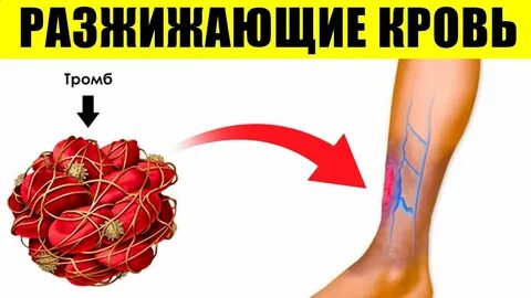 Что помогает от тромбов