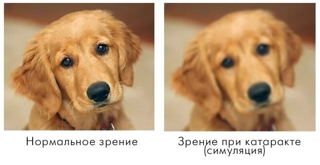 Как видят при катаракте. Как видит человек с катарактой. как видит человек при катаракте фото. зрение при катаракте как видит человек.