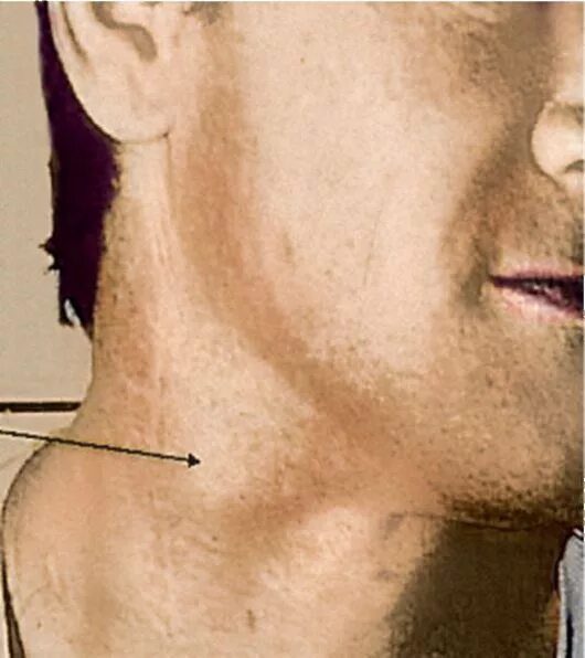 Как выглядит клещ энцефалитный: фото паразита-переносчика патологии вирусного пр