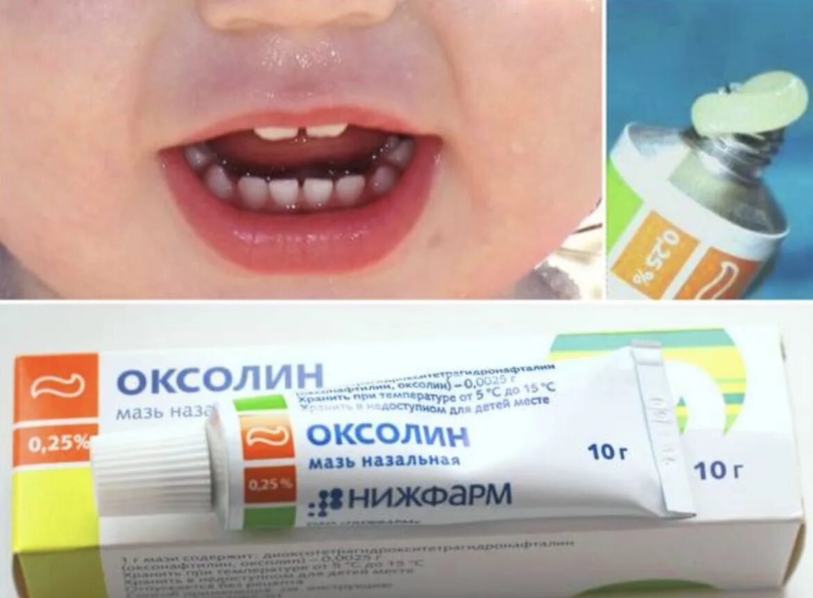 Что можно есть при стоматите