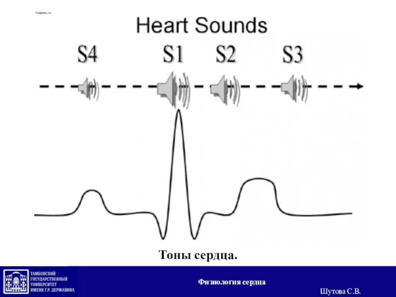 Звуки тона сердца. Тоны сердца. Тоны сердца на английском. Звучание тонов сердца. Сердце и тоны сердца.
