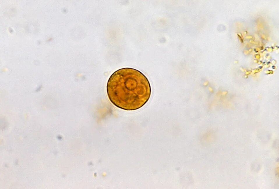 Entamoeba coli в кале. Entamoeba histolytica циста. Цисты лямблий микроскопия кала. Цисты лямблий под микроскопом.