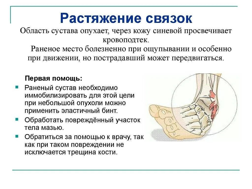 Первая при растяжении связок. Определение и признаки растяжения и разрыва связок. Разрыв связок характеристика травмы. • Растяжение, повреждение связок. Описание травмы растяжение.