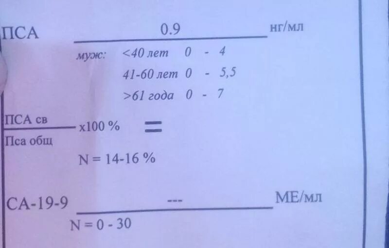 Норма пса у мужчин. Расшифровка анализа крови пса общий. Расшифровать анализ пса кровь. PSA анализ крови расшифровка. Расшифровать анализ крови пса у мужчин.
