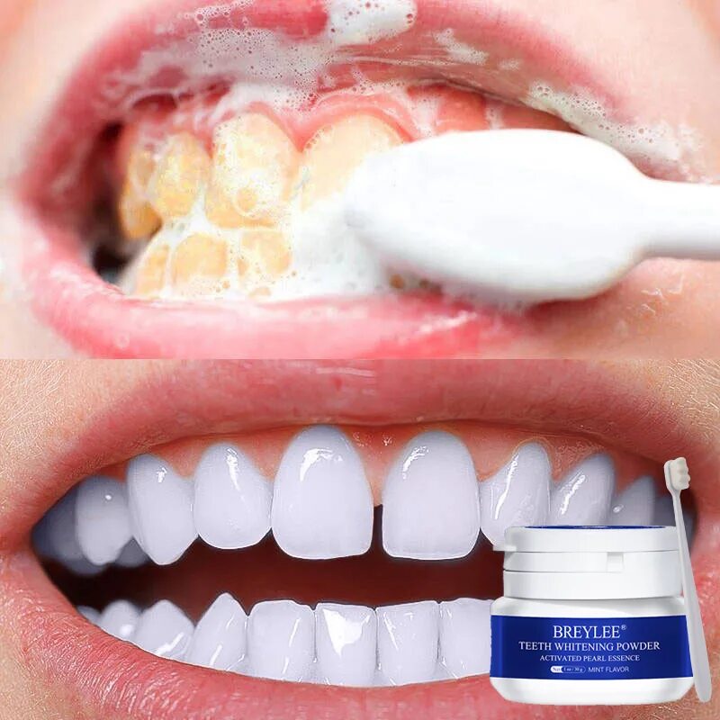 Гигиена полости рта стоимость. Зубная отбеливающая паста Tooth Whitening Toothpaste. Отбеливание зубов Teeth Whitening Essence. Профессиональное отбеливание.