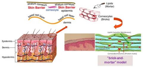 Skin barrier