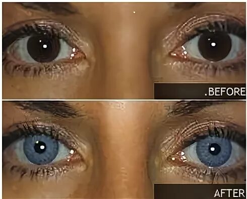 Изменение цвета глаз. Лазерное изменение цвета глаз. Линзы до и после. Карие линзы на карие глаза.