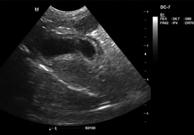 Мукоцеле желчного пузыря. УЗИ поджелудочной железы у собак. Воспаление поджелудочной железы у собаки УЗИ. Острый панкреатит у собаки УЗИ.