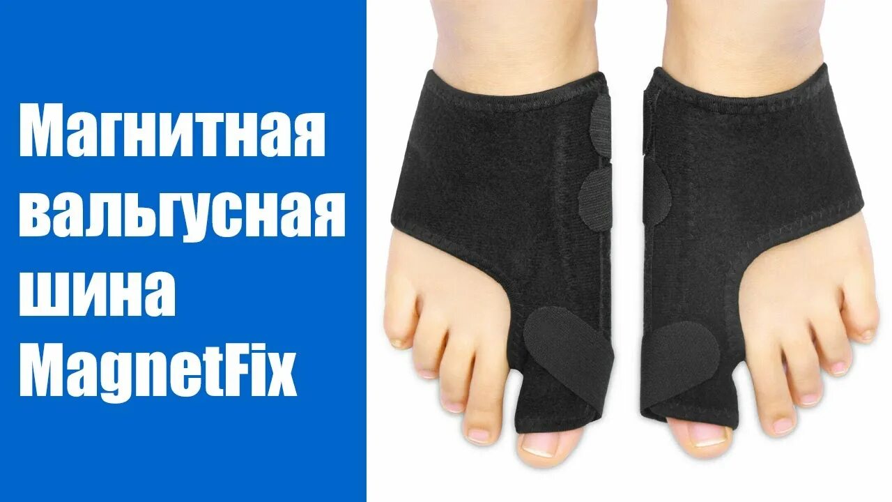 Как убрать вальгусную шишку