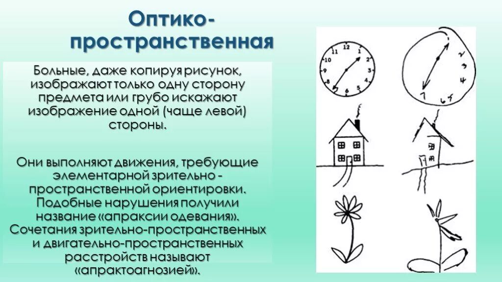 Пространственное нарушение