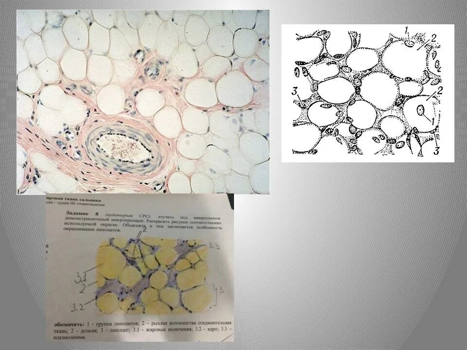 Жировая ткань сальника препарат. Жировая ткань гистология препарат. Жировая ткань строение гистология. Жировая ткань гистология рисунок.