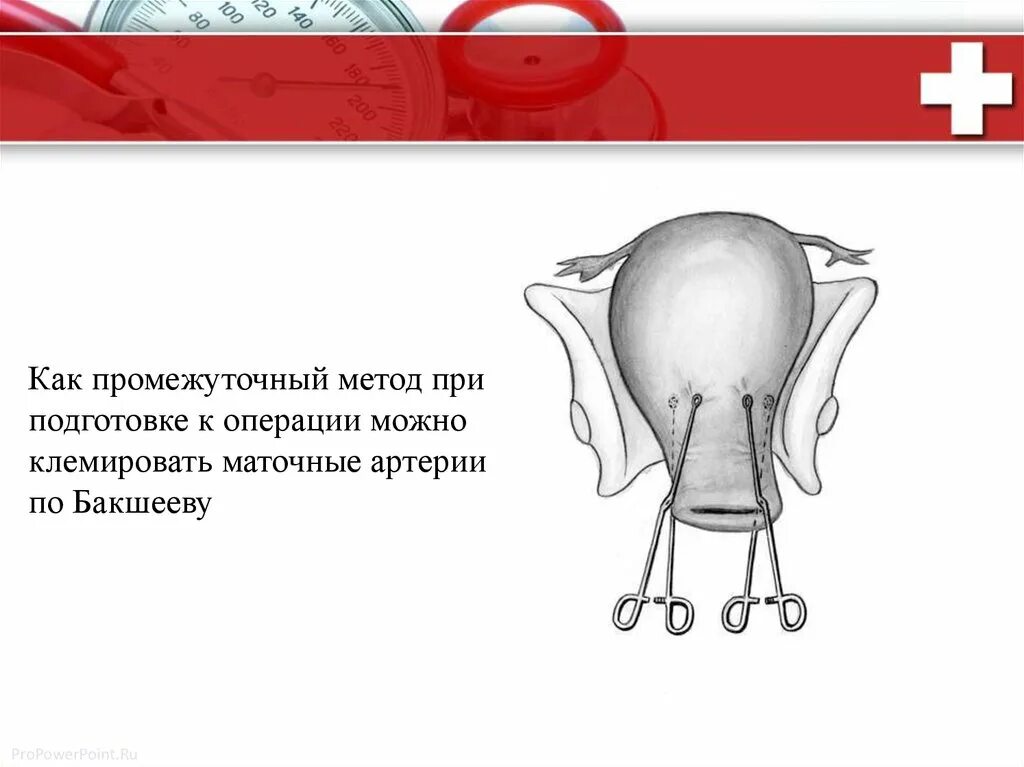 Параметрий это