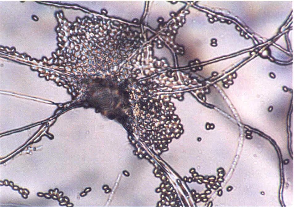 Microsporum canis микроскопия. Аспергилл кандида. Соскоб на мицелий. Несептированный мицелий. Trichophyton микроскопия.