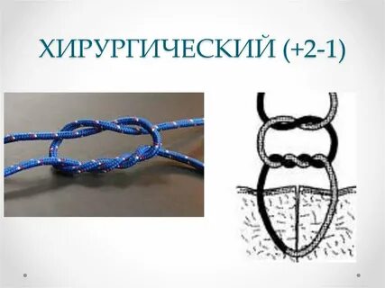 Хирургический узел