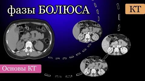 Великая кт