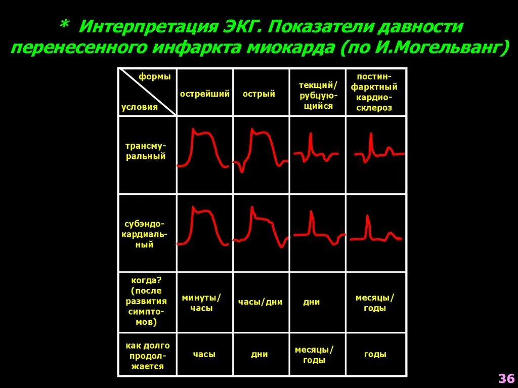 перенесенный инфаркт миокарда на экг. острый крупноочаговый инфаркт миокарда на экг. экг инфаркт миокарда остроподострая стадия. острый передний инфаркт миокарда на экг. переднебоковой инфаркт миокарда на экг.