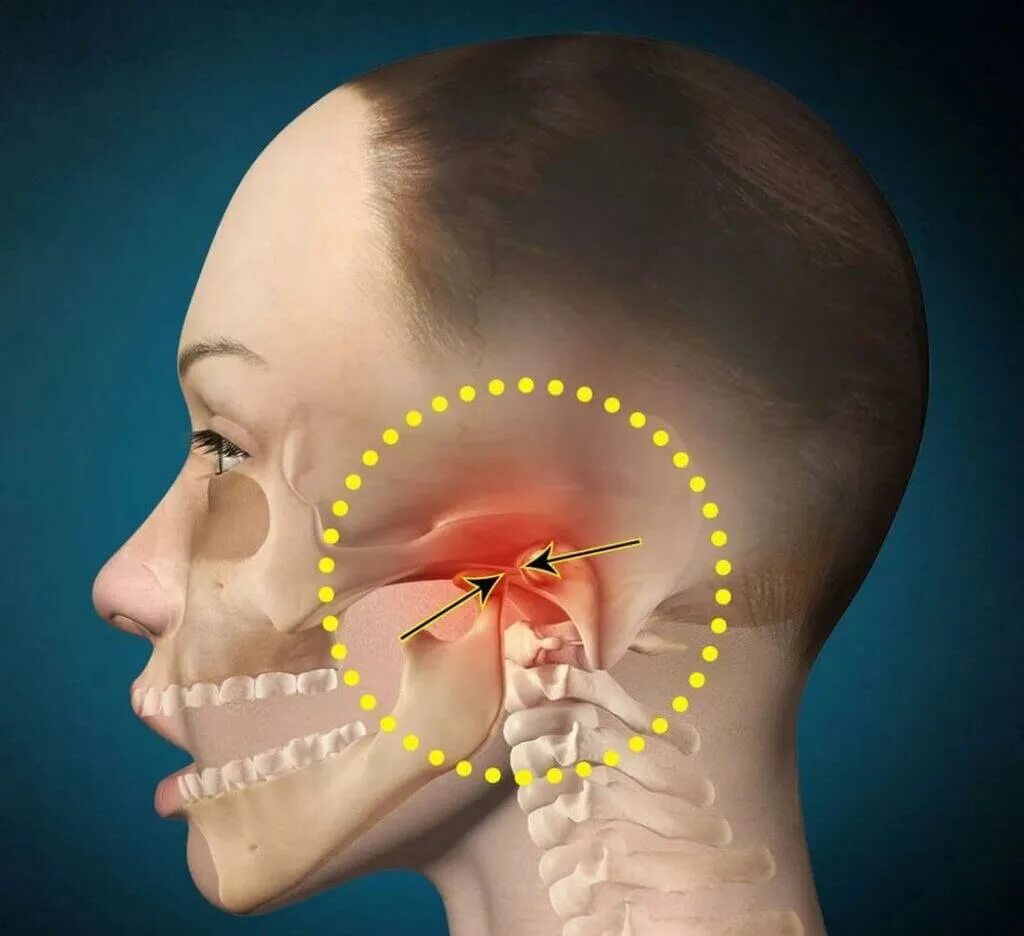 Боль в челюсти