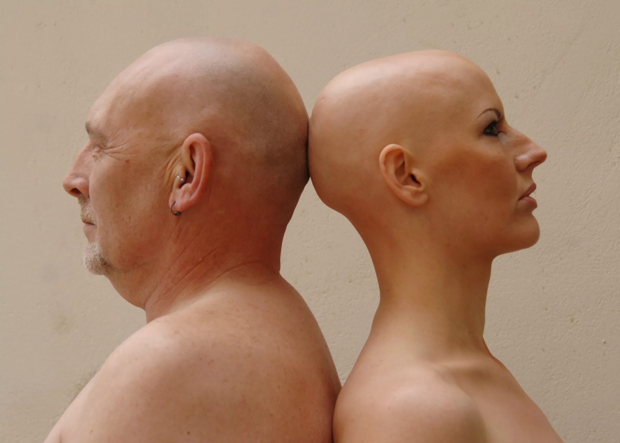 Люди с длинной головой. Лысая мужская голова. Лысая девушка и парень. Необычная форма головы.
