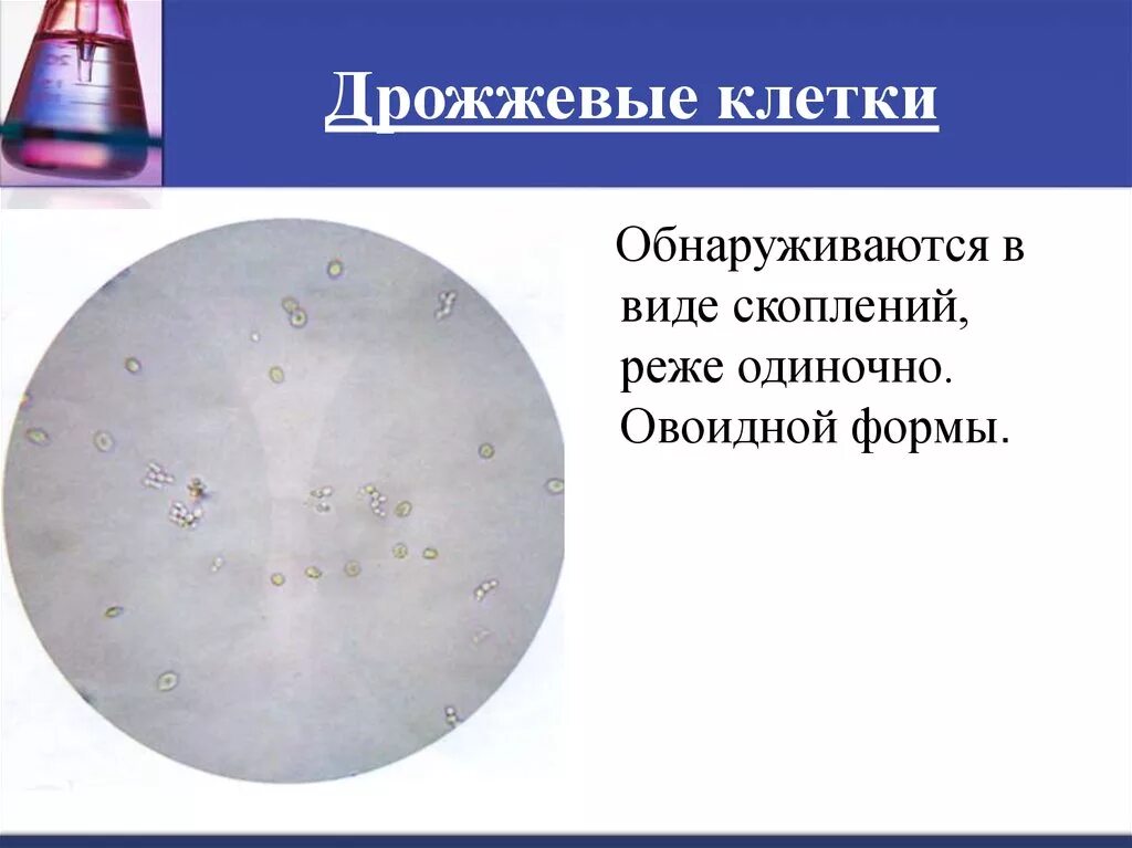Дрожжевые клетки в моче повышены