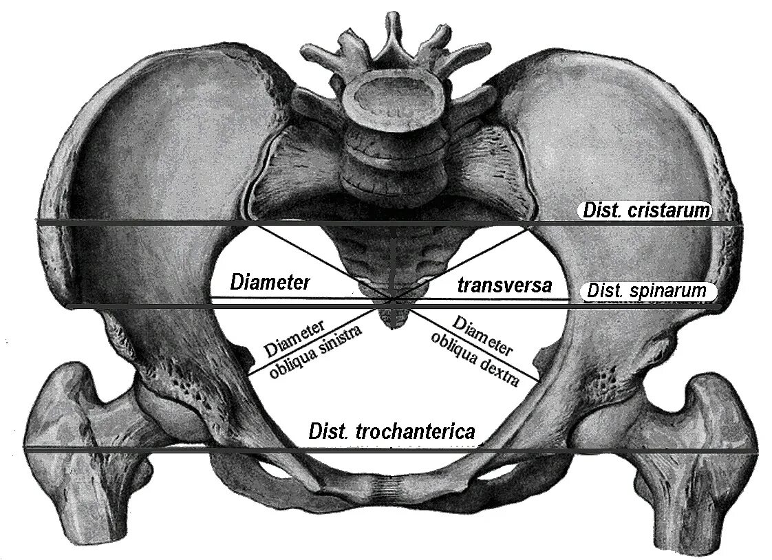 Дист ло. Размеры большого таза в акушерстве. Размеры женского таза в акушерстве. Размеры женского таза анатомия. Размеры нормального женского таза в акушерстве.