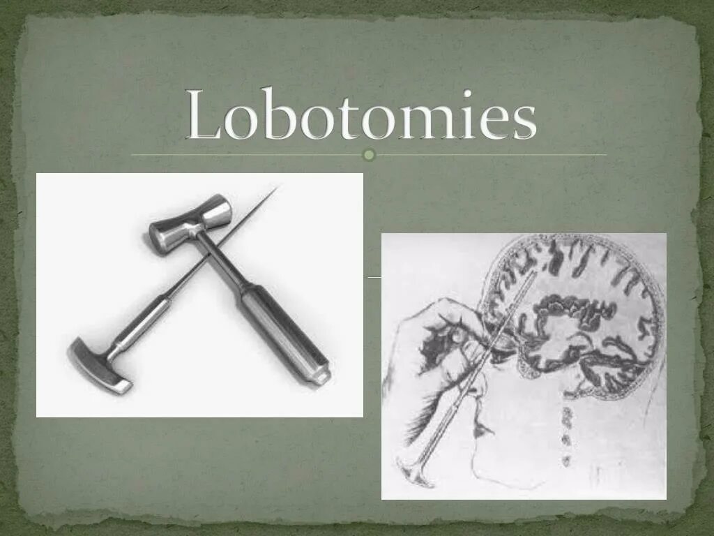 Нож для колки льда Лоботомия. Инструменты для лоботомии названия. Лоботомия текст