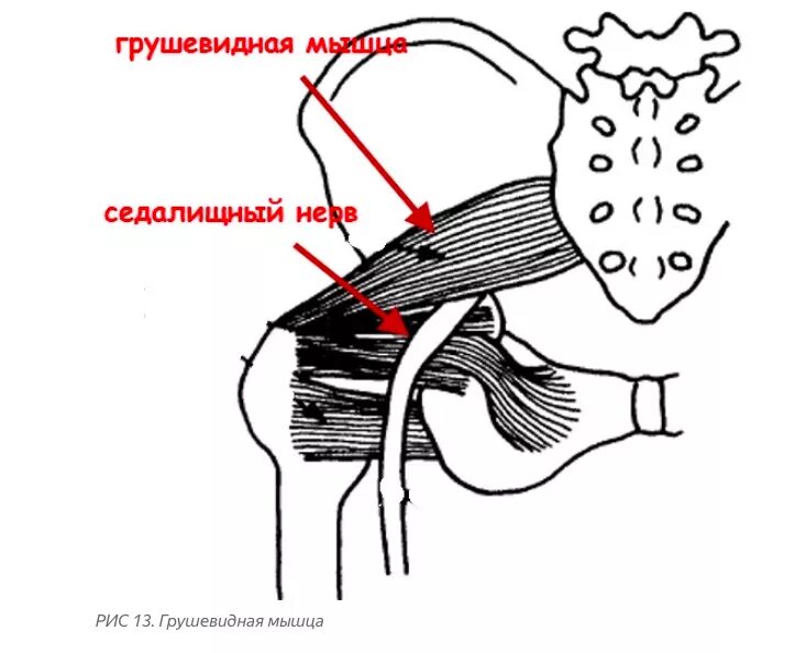 Мышца седалищного нерва. Синдром грушевидной мышцы триггерные точки. Грушевидная мышца тригер. Грушевидная мышца и седалищный нерв. Воспаление грушевидной мышцы тазобедренного сустава.