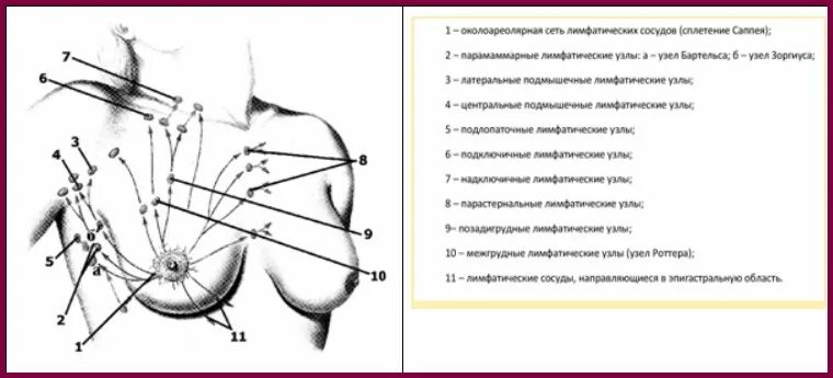 Лимфоузлы молочных желез норма. Подмышечные лимфатические узлы норма. Схема оттока лимфы от молочной железы. Аксиллярные лимфоузлы молочной железы. Регионарные лимфоузлы молочной железы.