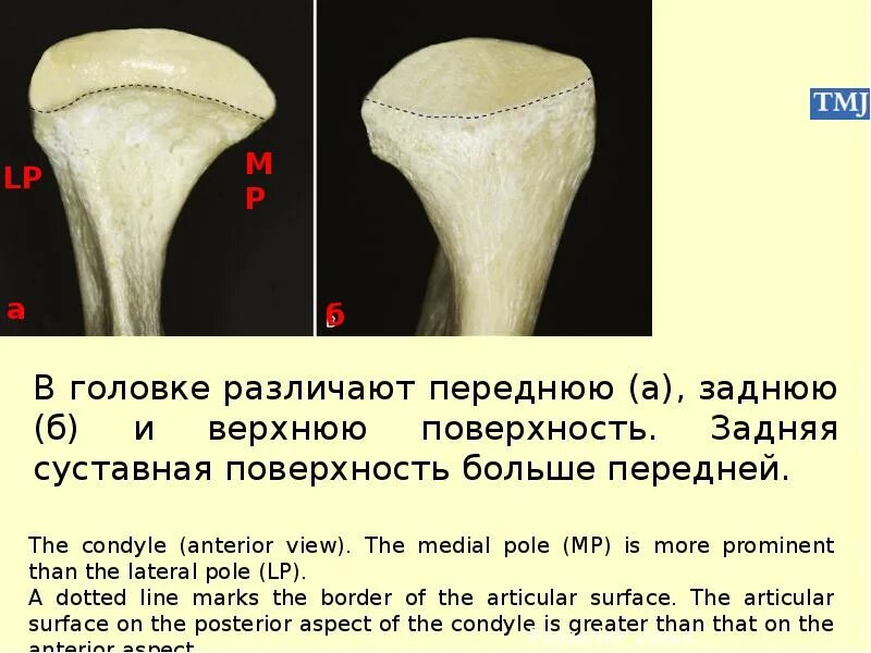 Форма головки члена. Височно-нижнечелюстной сустав строение. Классификация формы головки нижней челюсти.