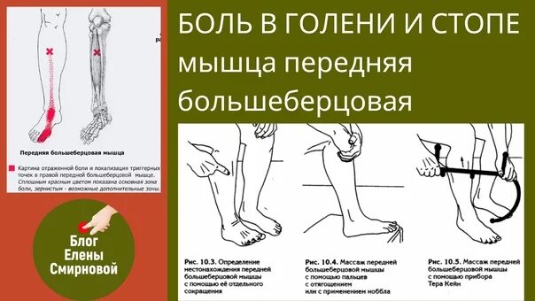 Болит колено после бега с внутренней стороны сбоку. Баловидная мышца анатомия. Мышцы икры ног анатомия. Болят ноги спереди при ходьбе. Болят ноги спереди при ходьбе.