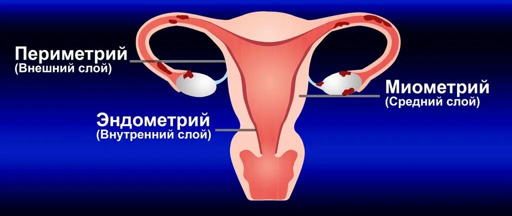 Эндометрия периметрий миометрий. Внутренняя стенка матки. Эндометрий и миометрий матки. Женские эндометрии
